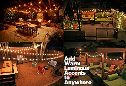 25Ft G40 Globe String Lights with Bulbs-UL Listed